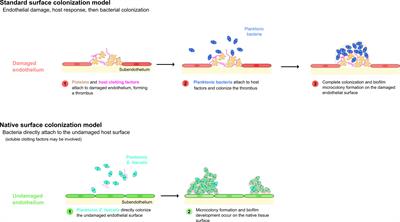 Enterococcal Endocarditis: Hiding in Plain Sight